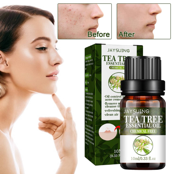 TEA TREE OIL - Ulje protiv akni - Slika 9
