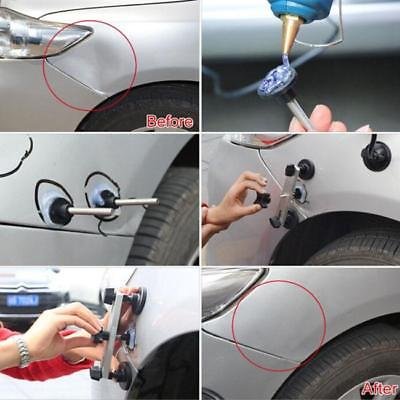 Pops-a-dent - Set za ispravljanje udubljenja na automobilu - Slika 8