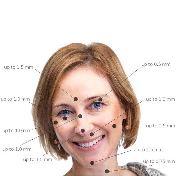 Derma roler - Slika 6